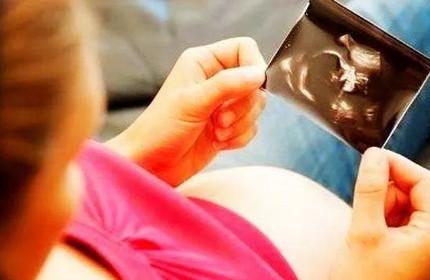 孕期不想胎儿脐带绕颈？改掉这5个习惯！