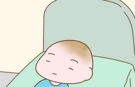 宝宝头上的乳痂要清理吗？