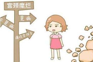 宫颈糜烂真的那么可怕？千万别被名字给吓到！