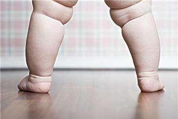 宝宝走路O型腿正常吗 要看医生吗