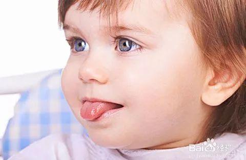 孩子的舌头出现这些症状，可就要注意咯！