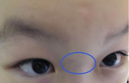 宝宝积食、反复感冒咳嗽究竟为何？