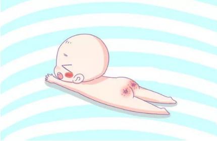 宝宝经常出现红屁股是为什么？这才是换尿裤的正确姿势！