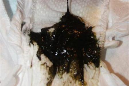 胎粪是什么颜色的图片 教你识别宝宝暗号