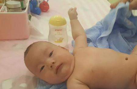 新生儿肚脐出现哪些问题，需要就医呢？