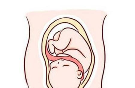 孕妈的这几个行为，很容易造成胎儿脐带绕颈！