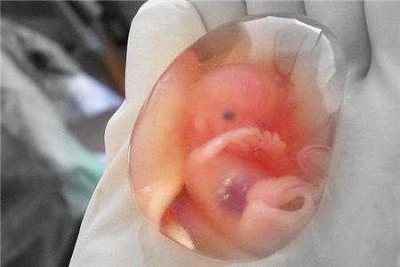 打过胎怎么还阴债 化解方法大合集