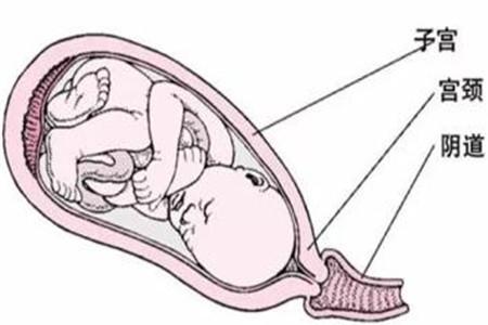会阴撕裂怎么护理 这些方面别忽视
