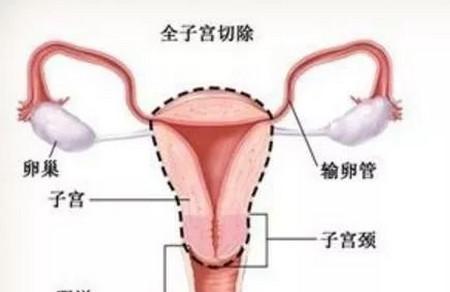 没了子宫，对女人到底有怎样的影响？