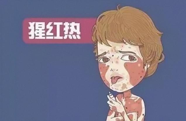 小儿猩红热的并发症