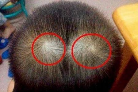 孩子头上一个旋、两个旋什么含义? 决定孩子的性格!