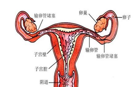 输卵管堵塞是怎么回事？