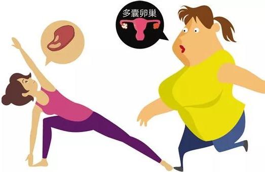 多囊卵巢综合征，有哪些常见的症状？