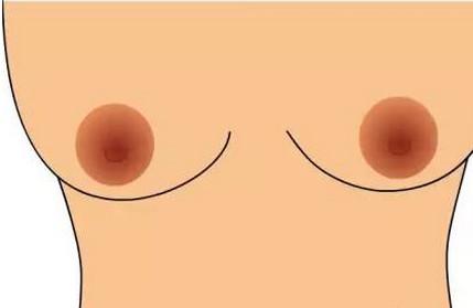 有以下特点的人都要小心“乳腺癌”，别不上心！