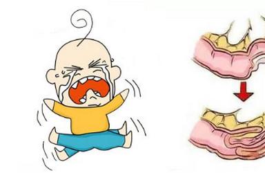 宝宝哭闹不止，还拉这样的便便，要警惕危险的“肠套叠”！