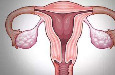很多不孕由输卵管引起，怎么做输卵管检查呢？