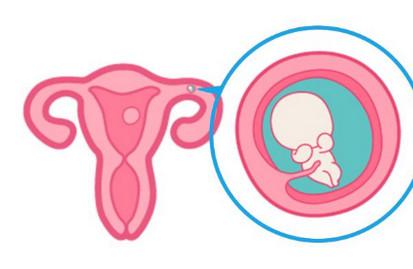 确诊宫外孕以后还能保留输卵管吗？