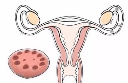 肥胖对生育有哪些影响？备孕需要减肥吗？