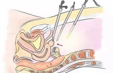备孕中，怎么知道自己的子宫内膜薄不薄？