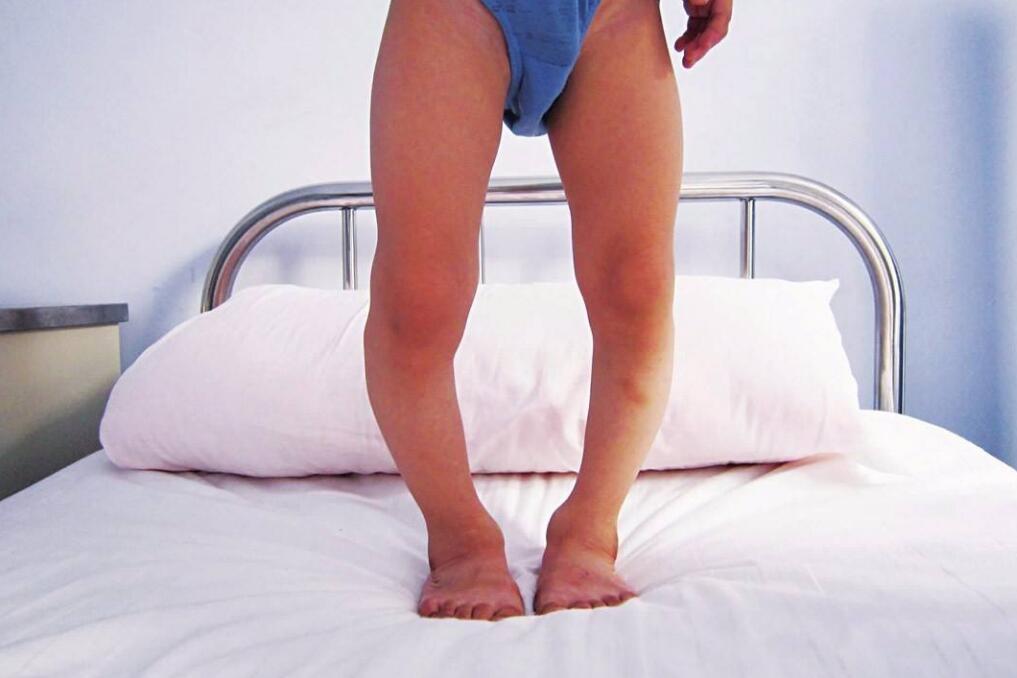 小儿佝偻病吃什么好