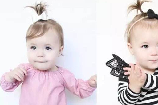 宝宝扎头发的危害 婴儿不宜过早扎头发