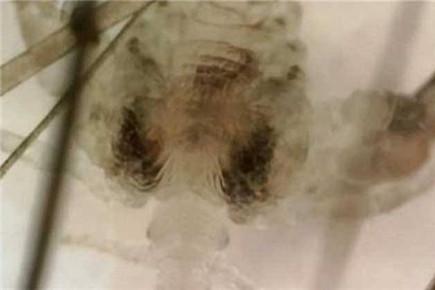 阴虱会爬入体内吗 阴虱居然这么可怕！