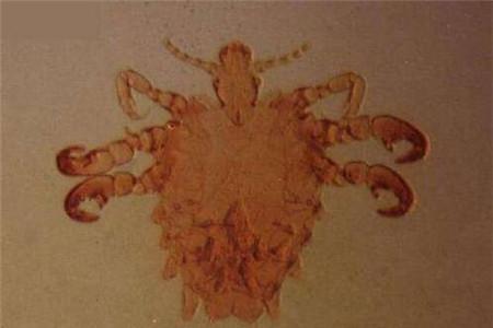 治疗阴虱最快的民间偏方 6个神奇偏方帮你摆脱尴尬！