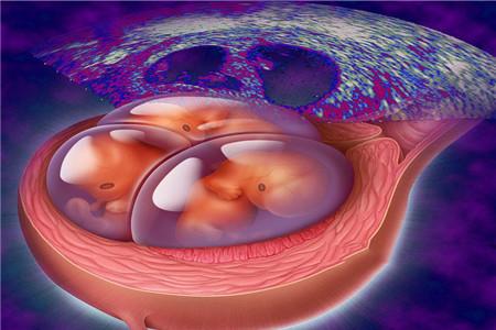 减胎后的胎儿怎么处理 不要太惊慌