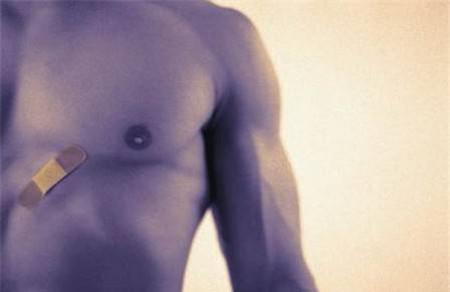 男性雌性激素分泌过多的表现 这几个症状一定要注意！