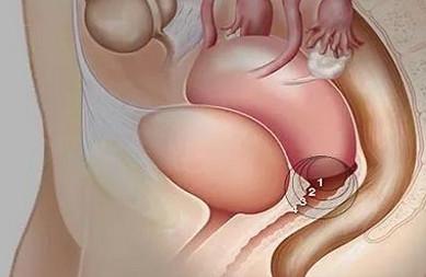 女性的白带变黄严重吗？要治疗吗？