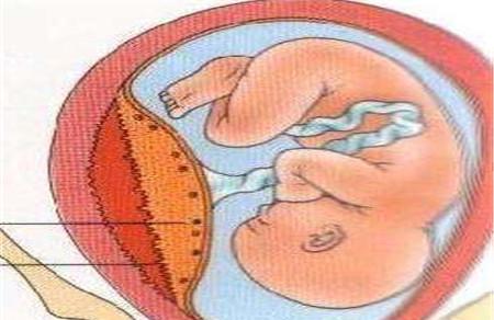 产后胎盘残留怎么处理方法 这些篇章帮助你