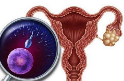 多囊卵巢综合征需要做哪些检查？