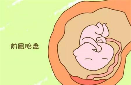 胎盘残留肚子痛吗 临床表现要知道