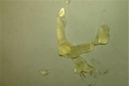 精子果冻状能生孩子吗 果冻状精子是不育的症状吗？