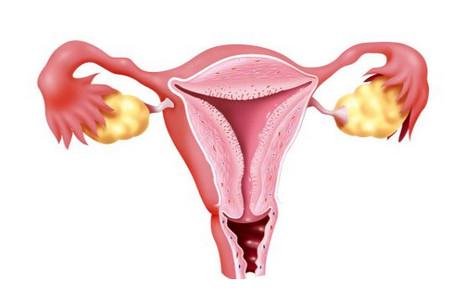 输卵管结扎对女性危害大，你还敢如此避孕吗？