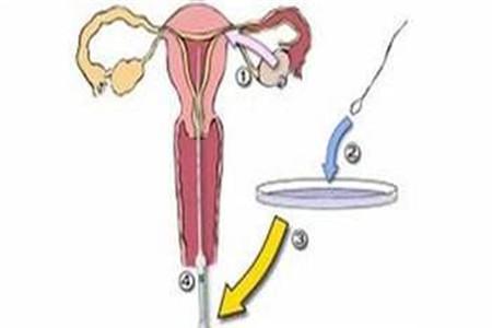 人工授精流程步骤 具体步骤详细讲解