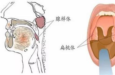 孩子张嘴睡觉爱翻身有什么危害？