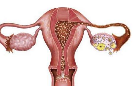 女性有多囊为什么要检查甲状腺？