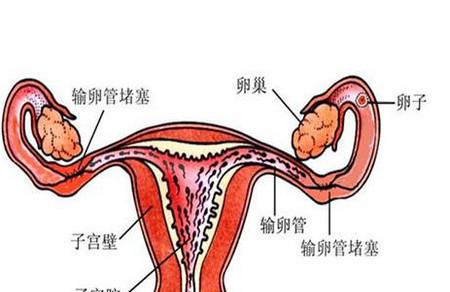 输卵管有问题怎么备孕