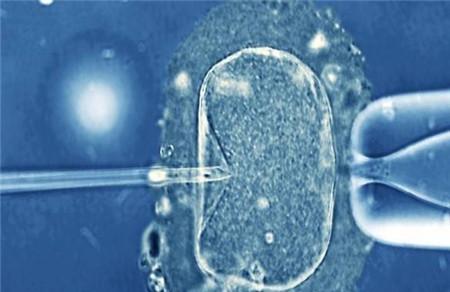 试管婴儿胚胎细胞级别 每级详细讲解