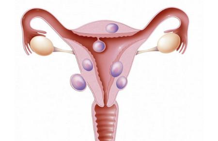 输卵管常见疑问解答，提高你的怀孕率
