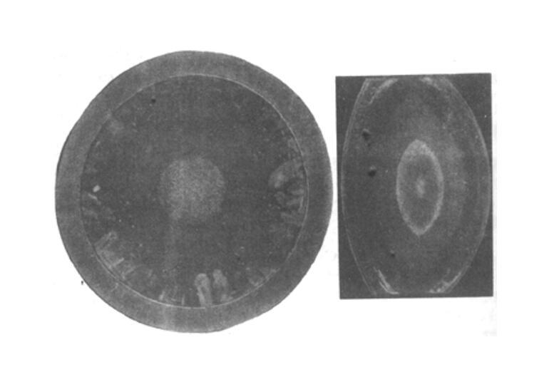 先天性白内障的原因
