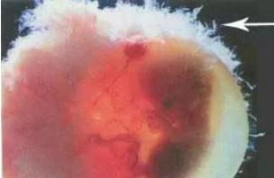 为什么有胎心胎芽了还会胚胎停育？你知道原因吗？