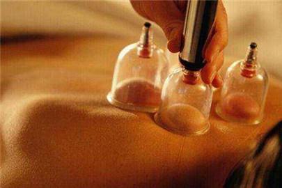 月经期间可以拔火罐吗 火罐不能随便拔！