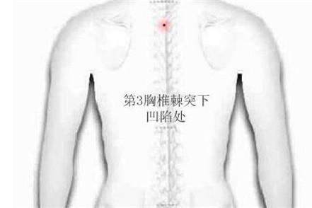 女性拔火罐位置示意图 这几个位置效果最好