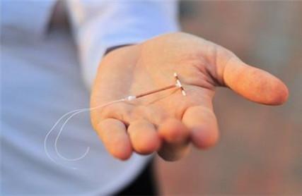 人流后多久可以上环 人流后可以上环吗？