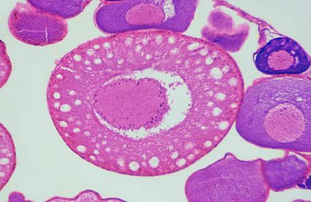 卵泡发育不好，有什么生育风险呢？