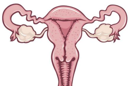 异常子宫出血的原因，关于子宫内膜局部异常