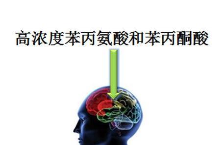 小儿苯丙酮尿症怎么治疗