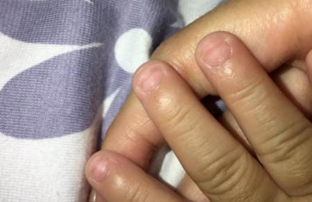 宝宝指甲长倒刺、有白点、有凹痕代表着什么？
